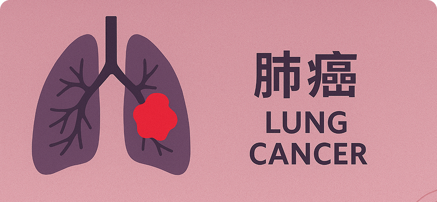 Lung cancer